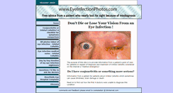 Desktop Screenshot of eyeinfectionphotos.com
