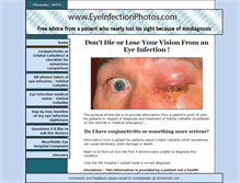 Tablet Screenshot of eyeinfectionphotos.com